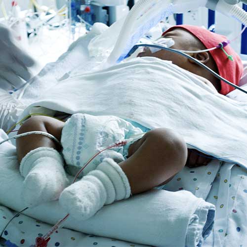 NICU patient