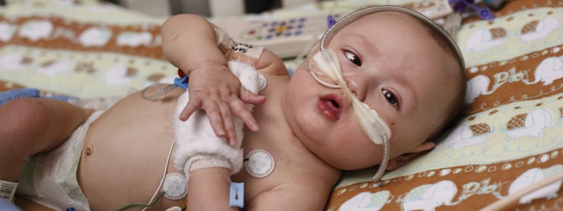 Young baby with heart condition