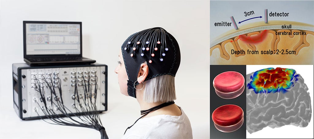 fNIRS-Figure-1---Left