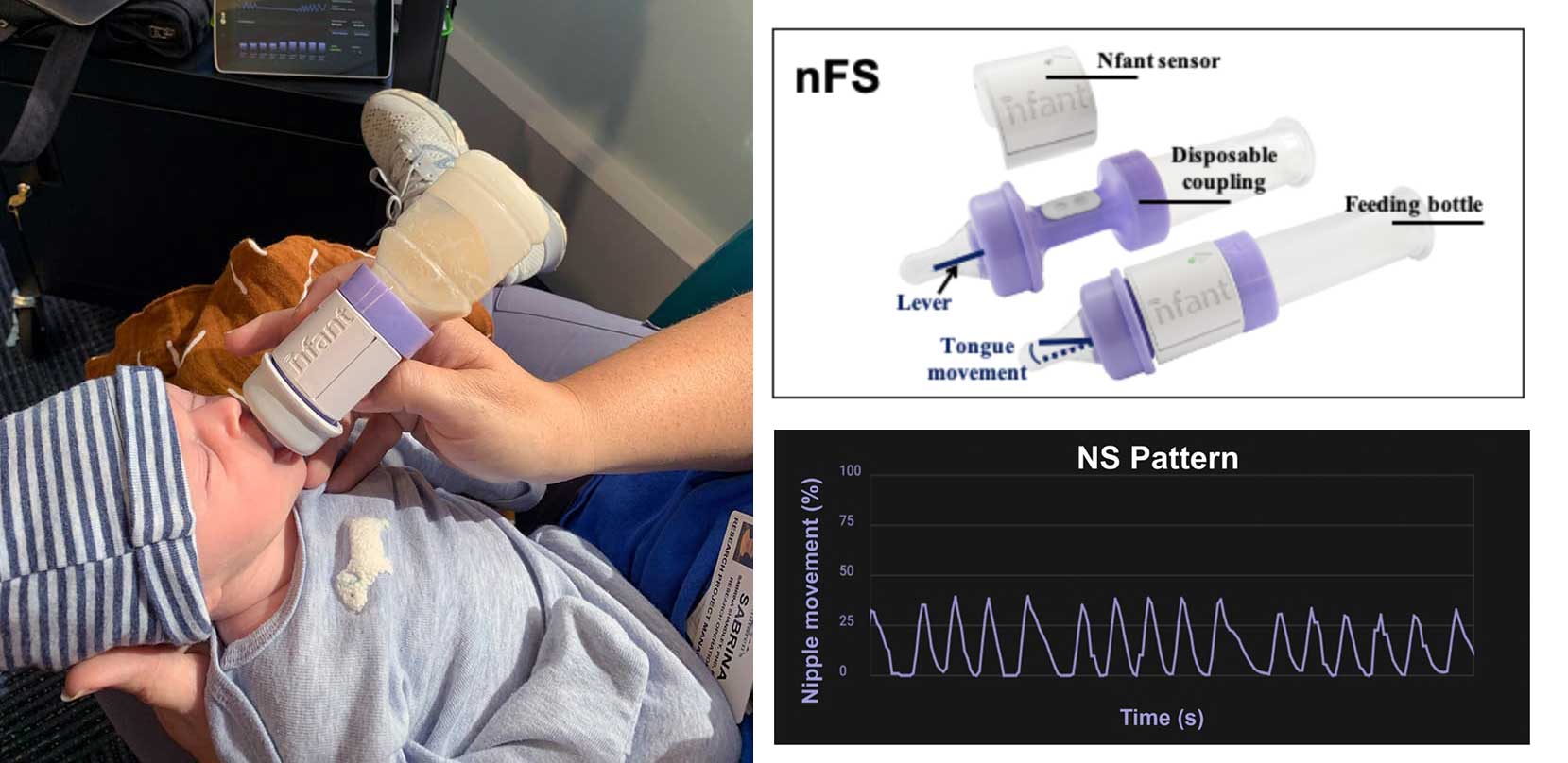 QUAN-Fig-3---quantitative-sucking-in-neonates