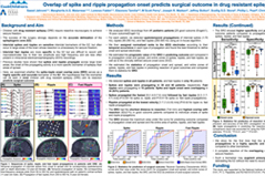 Overlap of spike and ripple propagation onset predicts surgical outcome in drug resistant epilepsy