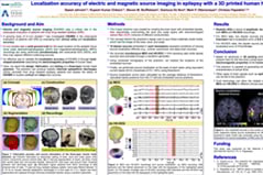 Localization accuracy of electric and magnetic source imaging in epilepsy with a 3D printed human head phantom