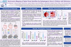 Noninvasive mapping of spike onset identifies the epileptogenic zone in children with refractory epilepsy