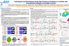 Pathological and physiological scalp high-frequency oscillations in children with drug resistant epilepsy and healthy controls