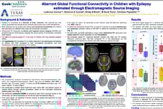 Diffusion tensor imaging localizes the epileptogenic zone in children with drug-resistant epilepsy
