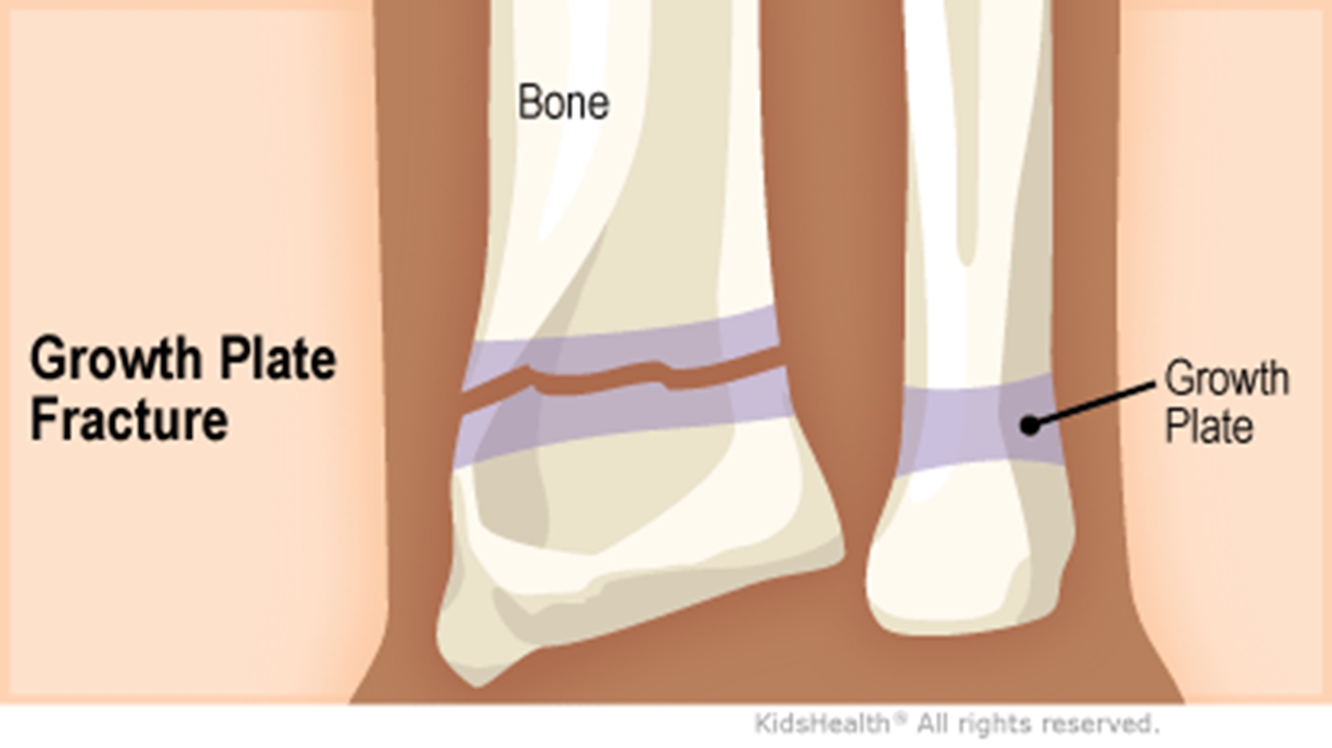 Top 5 Common Causes—and Controversial Conducts—of Heel Pain in Urgent Care  - Journal of Urgent Care Medicine