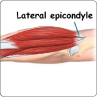 Lateral epicondyle anatomy