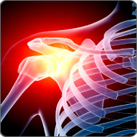 Shoulder joint Xray