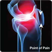 Kneecap pain anatomy