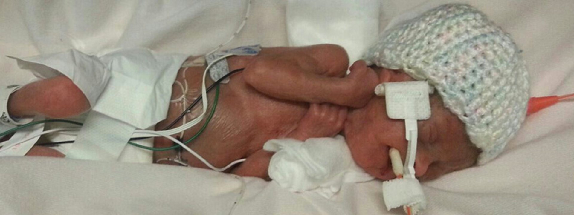 photo-preemiesmicropreemies-main